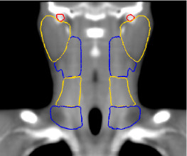 Head and Neck Atlas coronal slice