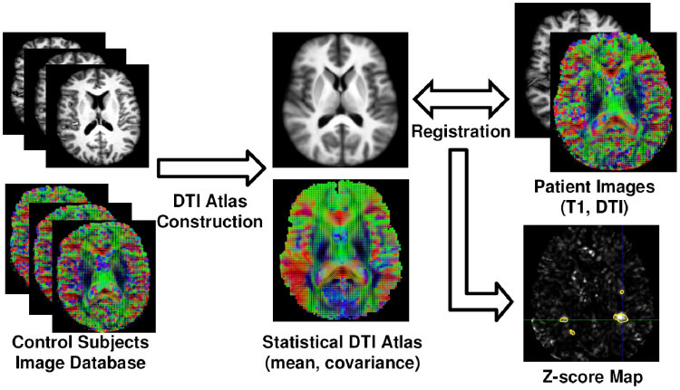 DTI Atlas based comparison scheme illustration