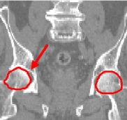 Prostate Reference Image