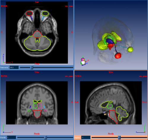 Example of a Brain Anatomical Atlas